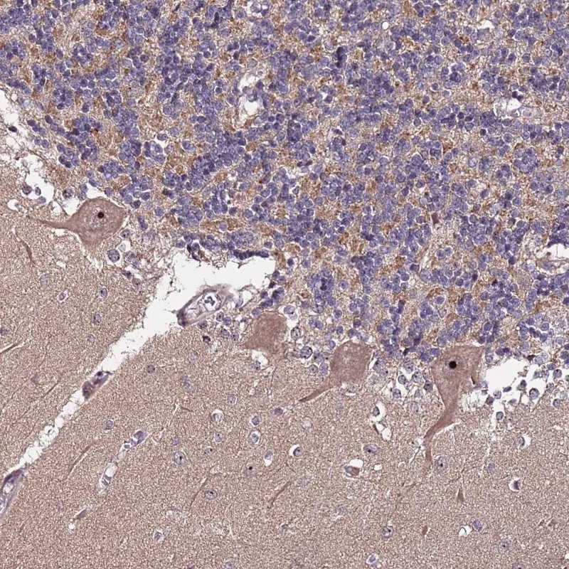 Anti-KRI1 Antibody