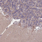 Anti-KRI1 Antibody