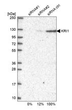 Western blot analysis in U2OS cells transfected with control siRNA, target specific siRNA probe #1 and #2, using Anti-KRI1 antibody. Remaining relative intensity is presented.