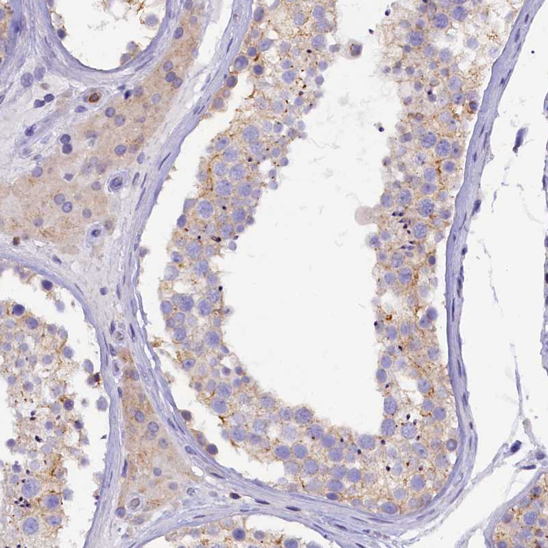 Anti-FAM193A Antibody