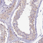 Anti-FAM193A Antibody