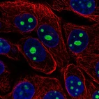 Immunofluorescent staining of human cell line MCF7 shows localization to nucleoli.