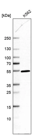 Western blot analysis in human cell line K562.