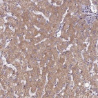 Anti-RCN3 Antibody