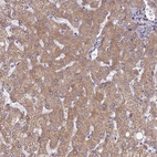 Anti-RCN3 Antibody