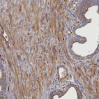 Anti-FILIP1L Antibody