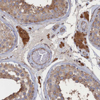 Immunohistochemical staining of human testis shows strong cytoplasmic positivity in Leydig cells.