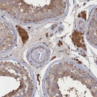 Immunohistochemical staining of human testis shows strong cytoplasmic positivity in Leydig cells.