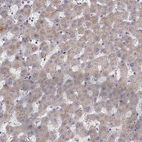 Immunohistochemical staining of human liver shows moderate cytoplasmic positivity in hepatocytes.