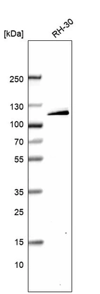 Western blot analysis in human cell line RH-30.