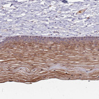 Anti-TYW1 Antibody