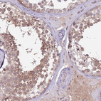 Immunohistochemical staining of human testis shows moderate cytoplasmic positivity in cells in seminiferous ducts.