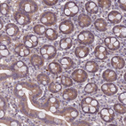 Immunohistochemical staining of human duodenum shows moderate cytoplasmic positivity in glandular cells.