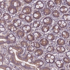 Immunohistochemical staining of human duodenum shows moderate cytoplasmic positivity in glandular cells.