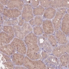 Immunohistochemical staining of human kidney shows weak cytoplasmic positivity in cells in tubules.