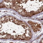 Anti-TMUB2 Antibody