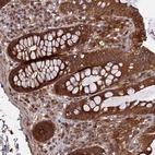 Immunohistochemical staining of human colon shows strong cytoplasmic positivity in glandular cells.