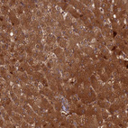 Immunohistochemical staining of human liver shows strong cytoplasmic positivity in hepatocytes.