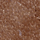 Immunohistochemical staining of human liver shows strong cytoplasmic positivity in hepatocytes.