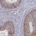 Immunohistochemical staining of human epididymis shows low expression as expected.