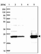 Lane 1: Marker [kDa] 250, 130, 95, 72, 55, 36, 28, 17, 10_br/_Lane 2: Human cell line RT-4_br/_Lane 3: Human cell line U-251MG sp_br/_Lane 4: Human plasma (IgG/HSA depleted)_br/_Lane 5: Human liver tissue