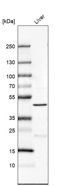 Anti-PRDM12 Antibody