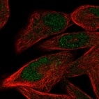 Immunofluorescent staining of human cell line RH-30 shows localization to nucleus.