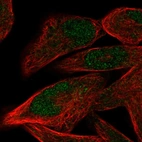 Immunofluorescent staining of human cell line RH-30 shows localization to nucleus.