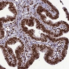 Anti-INO80E Antibody