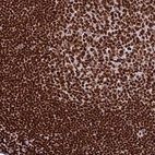 Immunohistochemical staining of human tonsil shows strong nuclear positivity in germinal and non germinal center cells.