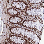 Immunohistochemical staining of human colon shows strong nuclear positivity in glandular cells.
