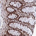 Immunohistochemical staining of human colon shows strong nuclear positivity in glandular cells.