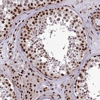 Immunohistochemical staining of human testis shows strong nuclear positivity in cells in seminiferous ducts and leydig cells.
