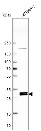 Western blot analysis in human cell line NTERA-2.