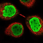 Immunofluorescent staining of human cell line A-431 shows localization to nucleoplasm.