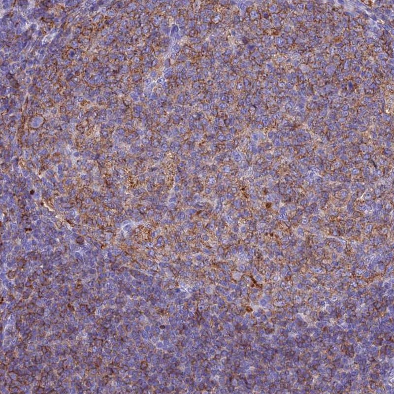 Anti-HLA-DRB1 Antibody
