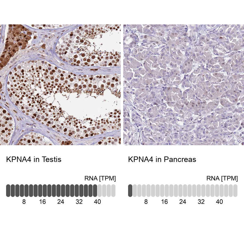 Anti-KPNA4 Antibody