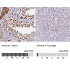 Anti-KPNA4 Antibody