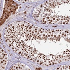 Immunohistochemical staining of human testis shows high expression.