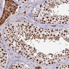 Immunohistochemical staining of human testis shows high expression.