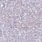 Immunohistochemical staining of human pancreas shows low expression as expected.