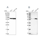 Western blot analysis using Anti-KPNA4 antibody HPA043154 (A) shows similar pattern to independent antibody HPA045500 (B).
