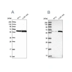 Western blot analysis using Anti-KPNA4 antibody HPA043154 (A) shows similar pattern to independent antibody HPA045500 (B).