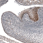 Immunohistochemical staining of mouse embryo E14 shows moderate to strong nuclear positivity in the developing teeth.