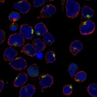 Anti-IRX1 Antibody