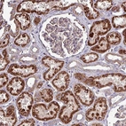 Anti-ZNF322 Antibody