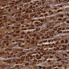 Anti-TMEM196 Antibody