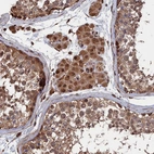Immunohistochemical staining of human testis shows strong granular cytoplasmic positivity in Leydig cells and cells in seminiferous ducts.
