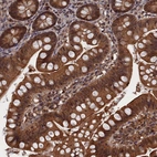Immunohistochemical staining of human small intestine shows strong cytoplasmic positivity in glandular cells.