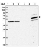Lane 1: Marker [kDa] 250, 130, 95, 72, 55, 36, 28, 17, 10_br/_Lane 2: Human cell line RT-4_br/_Lane 3: Human cell line U-251MG sp_br/_Lane 4: Human plasma (IgG/HSA depleted)_br/_Lane 5: Human liver tissue_br/_Lane 6: Human tonsil tissue